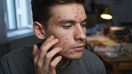 Мужчина чешет лицо