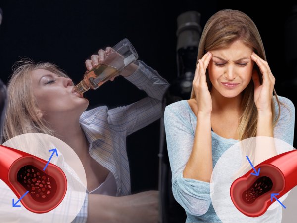 Сосуды и алкоголь